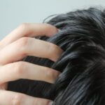 頭皮出油該怎麼辦？5個改善油性頭皮的方法